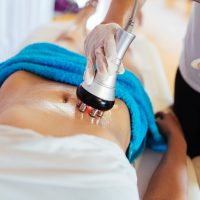 Cavitation,Rf,Body,Treatment,And,Contemporary,Medicine,For,Health,Beauty